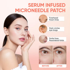 NOVALIFT MicroGlow Eye Patches under-eye application shows soothing, refreshing care.