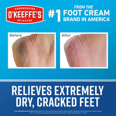 O'Keeffe's Healthy Feet applying cream on feet for dry skin relief.