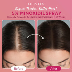 OLIVITA minoxidil spray quick-dry absorbs instantly to fit busy mornings.