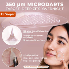 OMMA patch on skin during overnight use for early-stage zits