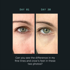 oneskin EYE OS-01 application around the eye area for precise, soothing use