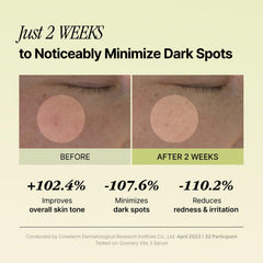 OOZNARY Vita 3 Serum label features Centella Asiatica and glutathione ingredients.
