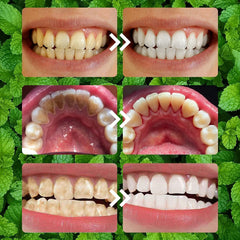 Oprtuisi Fresh mouth feel after use during daily routines.