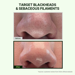 Orien Mugwort Zero Film Cleansing Oil applied on face demonstrates gentle cleansing.