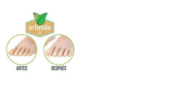 Close-up of nails treated with Oriundo Natural Life showing healthier appearance.