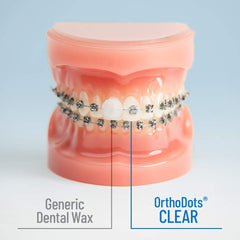Orvance OrthoDots clear aligner edge coverage for a comfortable fit.