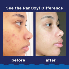 PanOxyl facial and body cleanser packaging emphasizing convenience for on-the-go skincare.