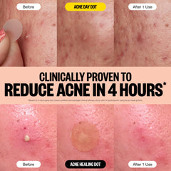 Peace Out Aloe Vera soothing gel calms redness around breakouts