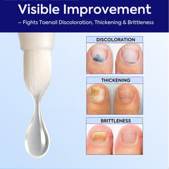 PHARMBANNER Nail File included to prep and smooth the nail surface.