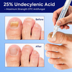 PHARMBANNER Nail Fungus Treatment Pen tip close-up for precise application.
