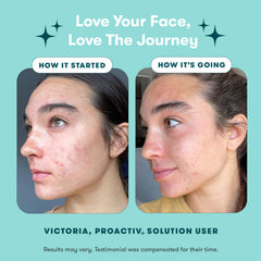 Proactiv Repairing Treatment tube for targeting blemishes