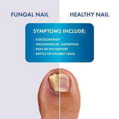 Clear, fast-drying formula from ProClearz Fungal Shield for comfortable skin.