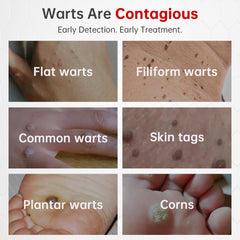 QQE Wart Remover NDC label closeup confirms safe OTC solution.
