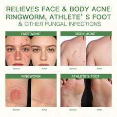 QualiLife Tea Tree Oil drops emphasize natural ingredients for balanced skin.