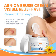 Redcool Arnica Cream texture close-up highlights rich, non-greasy hydration for sensitive skin.
