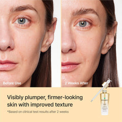 REJURAN Ampoule packaging demonstrates easy, daily use.
