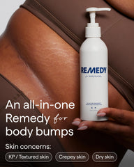Remedy Science KP Exfoliating Body Moisturizer cream swirl highlights rich texture for KP care.