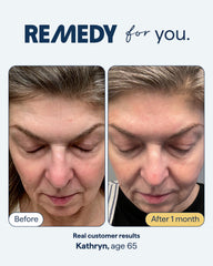 Remedy Science retinaldehyde delivery label highlights nighttime care benefits.