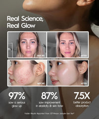 REVOMADIC REVO Genie lymphatic drainage wand reduces puffiness for refreshed look.