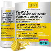 Rida Hair Psoriasis Shampoo bottle with Manuka Honey for soothing scalp relief.