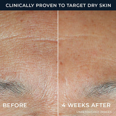 RoC Hydration+ Serum texture on skin reveals a milky, lightweight finish.