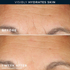RoC Retinol capsules applied to skin suggesting smoothing and firming potential