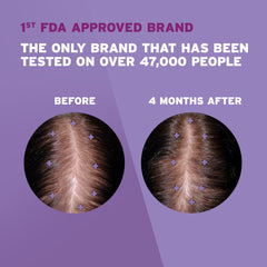 Rogaine Women’s 2% Minoxidil being applied to the scalp for targeted treatment