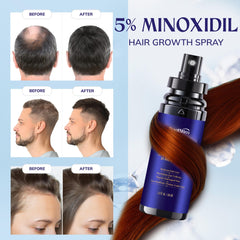 RootStim two-pack packaging for uninterrupted hair growth routine