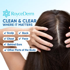 Roycederm serum applied to scalp as part of a daily calming routine.