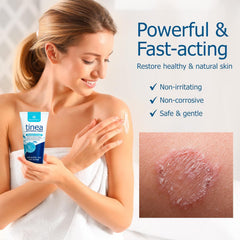 Roycederm tinea treatment tube ready for easy, on-the-go application.