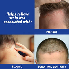 Scalpicin clear formula pour demonstrates easy, greaseless scalp treatment.