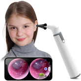 ScopeAround otoscope light offers clear ear inspection for safer home checks.