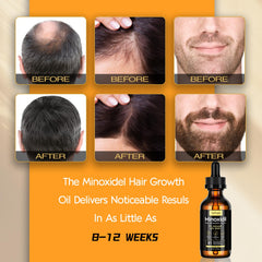 Sefralls Minoxidil oil with biotin infusion supports healthier regrowth and hair strength.