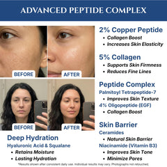Seraphime ingredients highlight niacinamide and EGF for refined texture