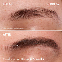 NeuBROW brow area with fuller, defined look.