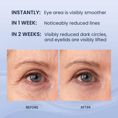 SKIN ULTIMA lower eye cream smoothing puffiness and dark circles