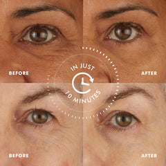 Skyn ICELAND Hydro Cool Under Eye Patches applying on skin to de-puff