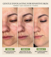Srripo vitamin C and turmeric brighten complexion with gentle polishing.