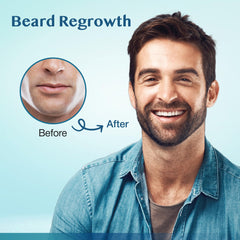 Stafenit beard regrowth application on facial hair during daily routine