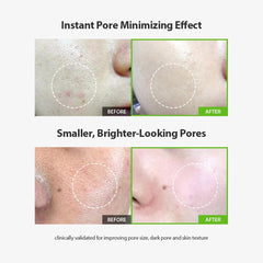 Sungboon Editor Green Tomato Pore Lifting Ampoule applied to the skin for a smoother look.