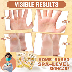 TEAWOO hand mask on with gloves for convenient at-home care.