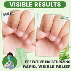 TEAWOO Hand Patches on cracked skin showing relief during wear.