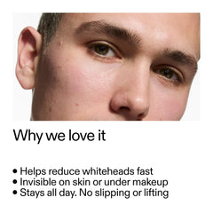 The INKEY List pimple patch closeup on skin demonstrates ultra-thin, matte finish for undetectable wear.