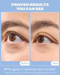 Then I Met You snail mucin eye cream texture close-up showing lightweight hydration.