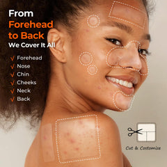 TKTK Pimple Patches 356-count packaging showcases value and convenience