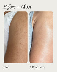 Topicals Slather application on skin targeting rough patches