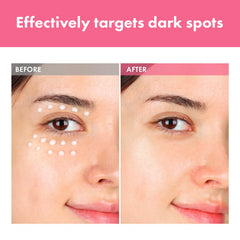 TOSOWOONG Arbutin 7-percent ingredients panel highlighting niacinamide and tranexamic acid.