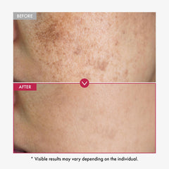 TOSOWOONG Niacinamide serum pink color hints at gentle, soothing hydration.