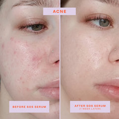 Tower 28 SOS Rescue Face Serum pump close-up, easy and precise application.
