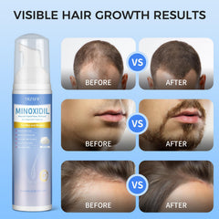 Trzsfr DHT-blocker formula icon suggests long-term support for healthier scalp.